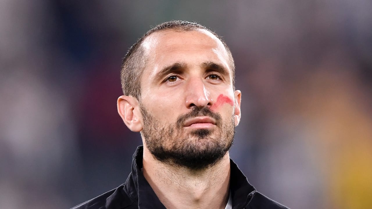 Giorgio Chiellini vẫn tin rằng Juventus sẽ chơi tốt cho dù vắng bóng Cristiano Ronaldo